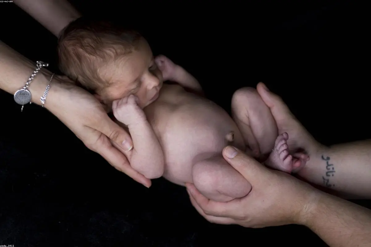 A Major Healthcare Win: Jesy Nelson Hails New Life-Saving Screening for Newborns