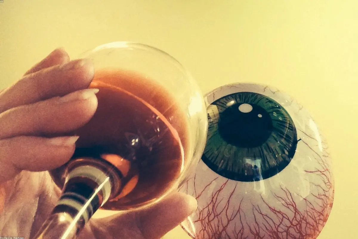 Beyond the Glare: Understanding and Treating Bloodshot Eyes Effectively