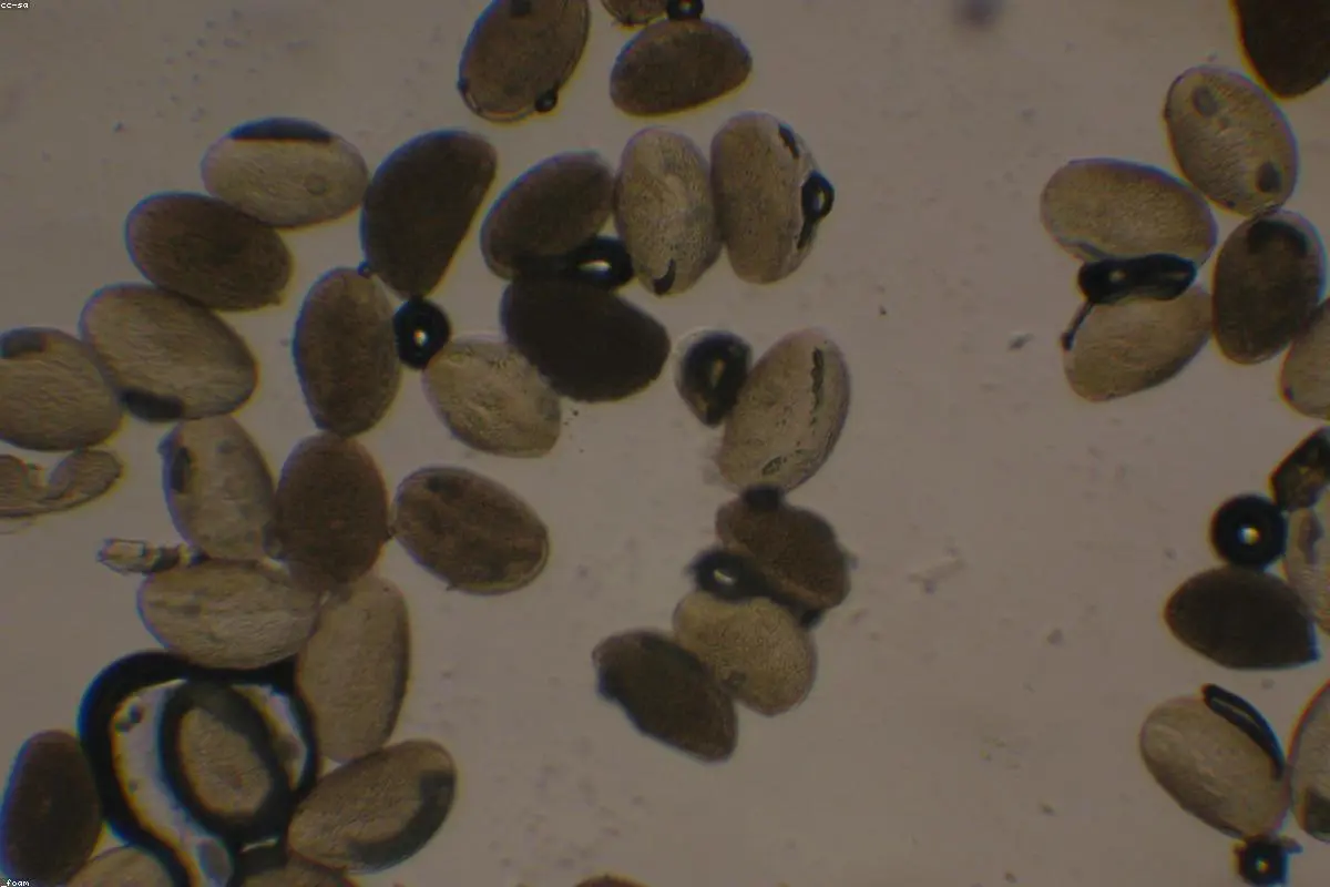 Pollen Season Stretching? Why Your Hay Fever Feels Worse (and What You Can Do)